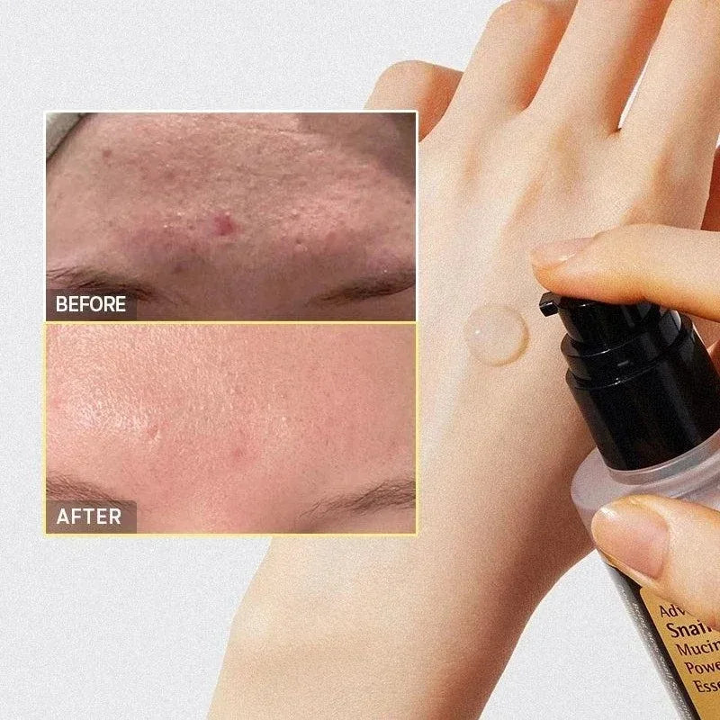 Korean Snail Mucin 96% Hydrating Face Serum